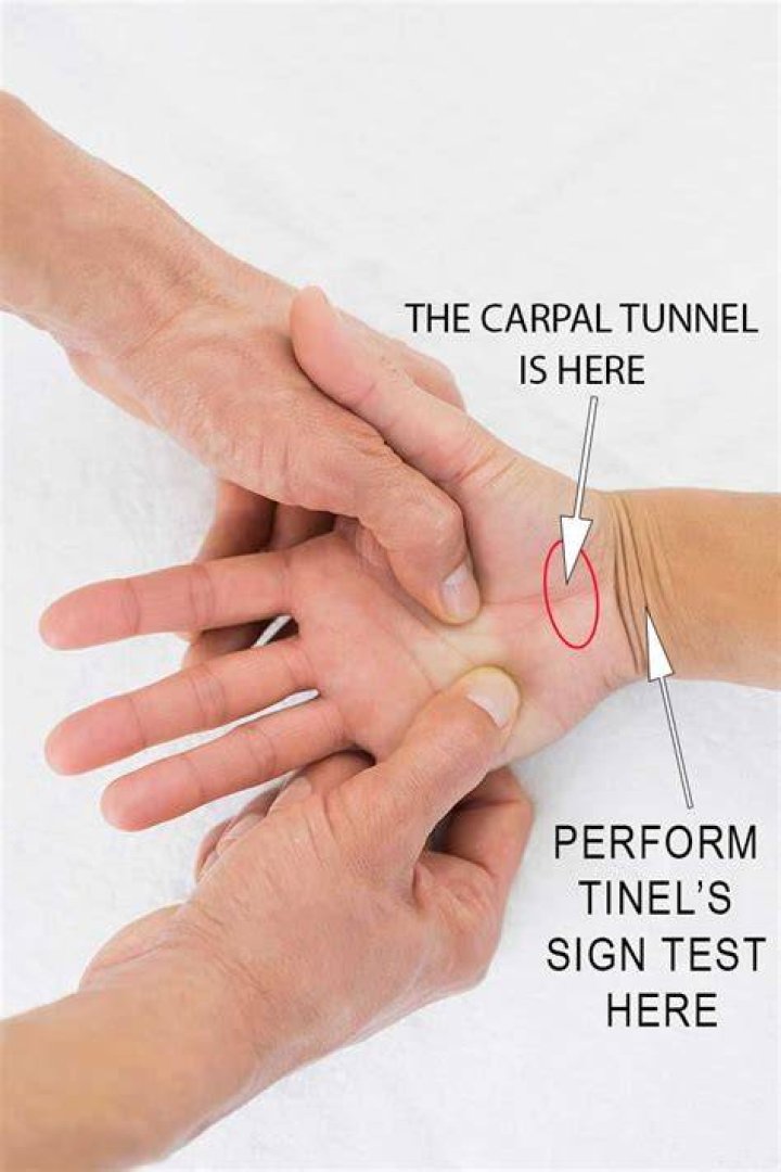 Does carpal tunnel testing hurt?