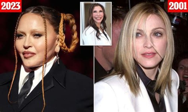 Phoebe Dynevor's Plastic Surgery: Unveiling The Truth