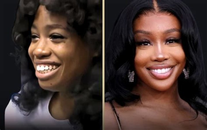 Summer Walker Before Surgery Unveiled
