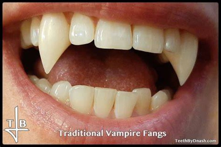 What are your vampire teeth called?
