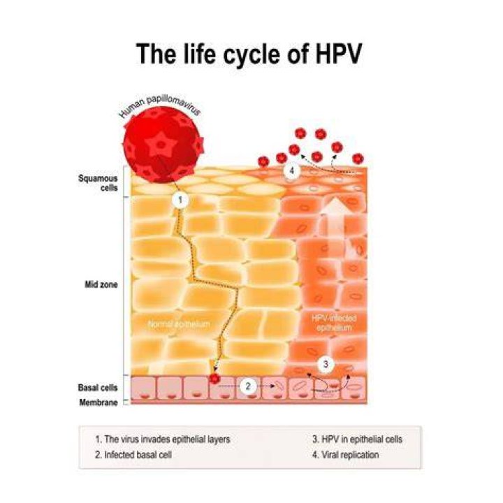 What causes HPV to flare up?